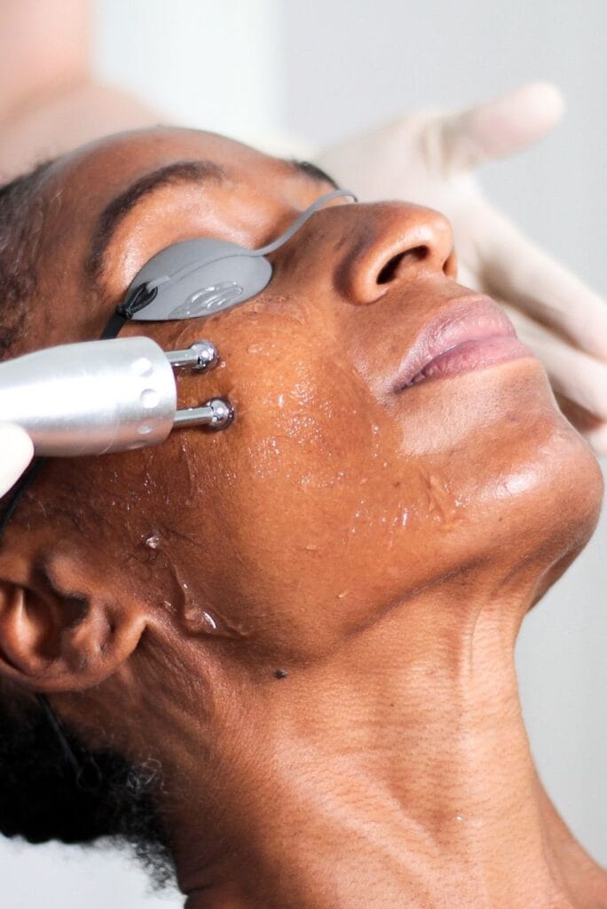 RF facial