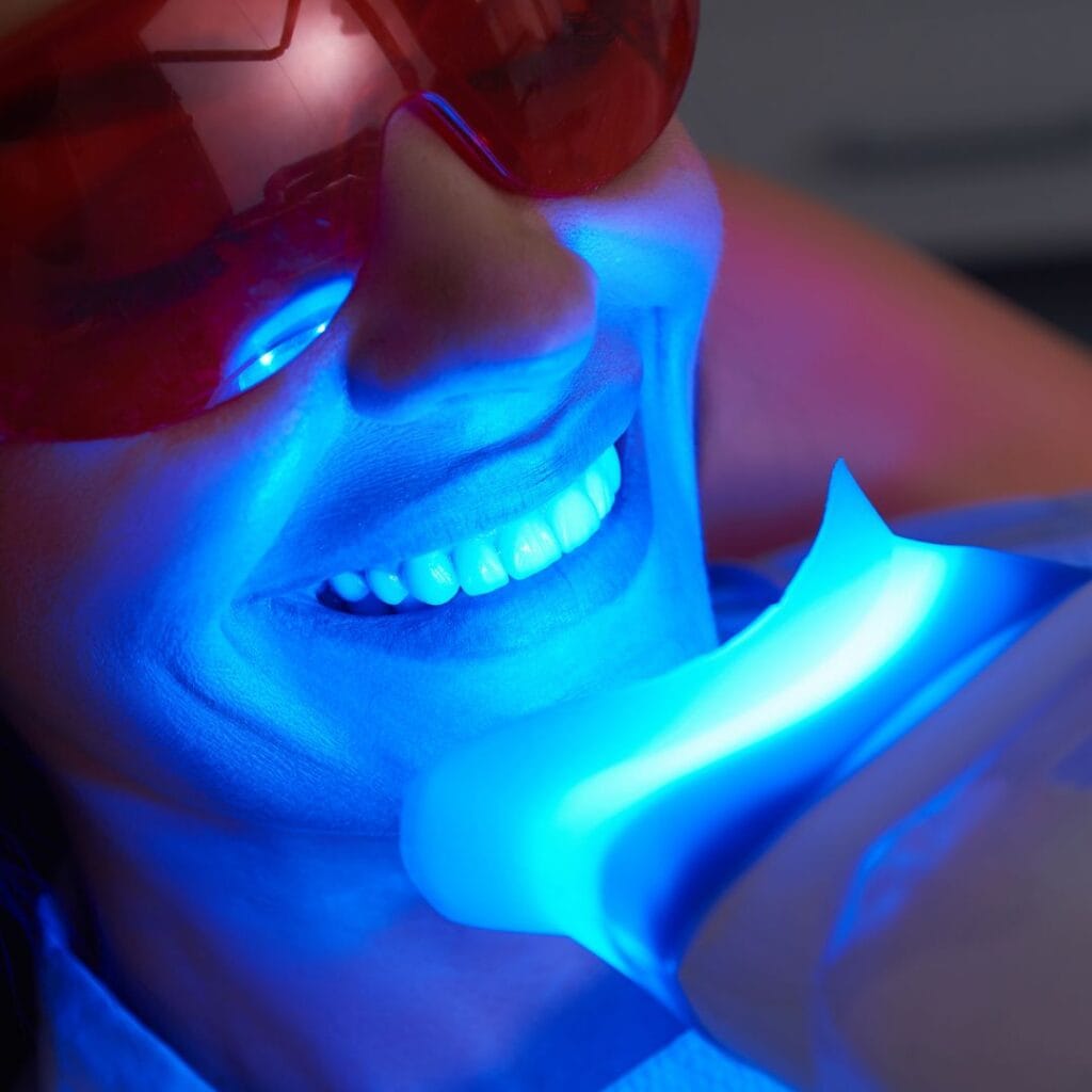 teeth bleaching