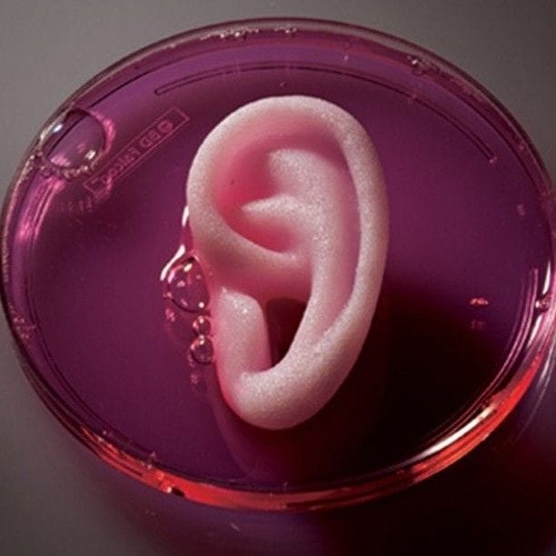 3D Printing in Medicine